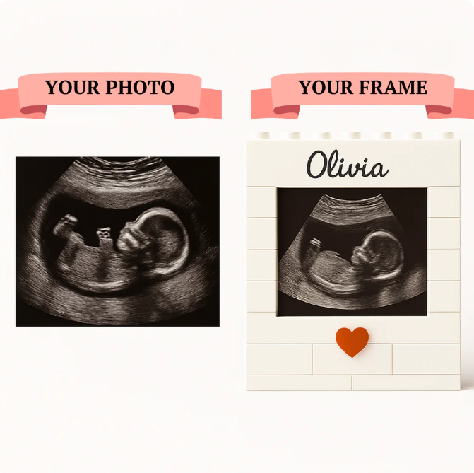 Custom Ultrasound Block Frame