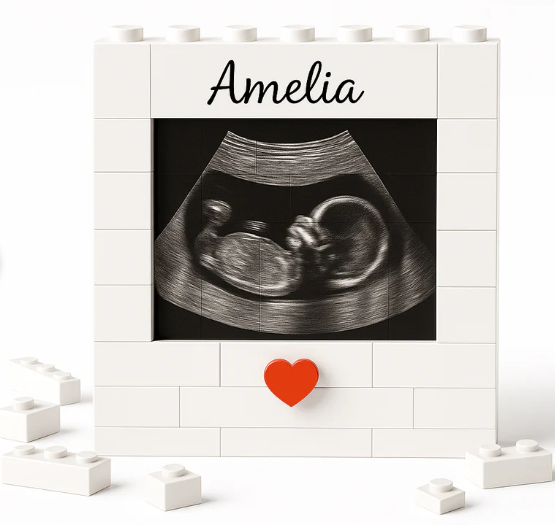 Custom Ultrasound Block Frame